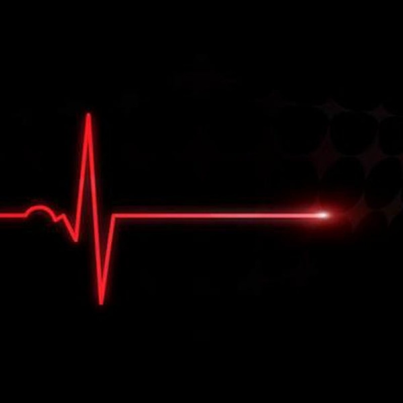 Сердцебиение остановилось. Пульс остановился. Кардиограмма остановки сердца. Сердце остановилось. Прямая линия на кардиограмме.
